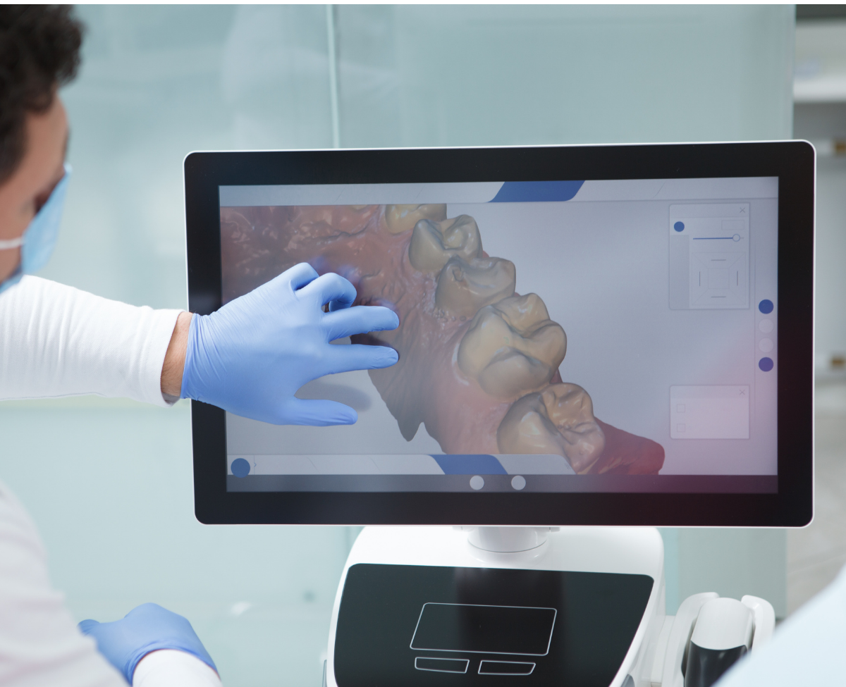 3D dental scan on screen