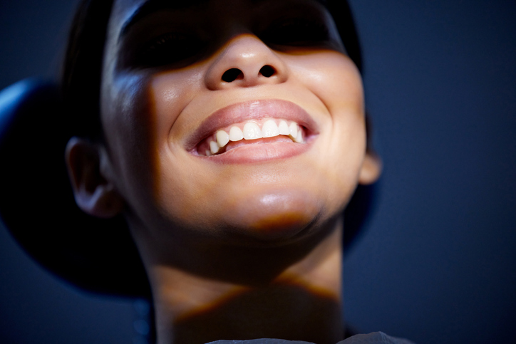 Beautiful smile result